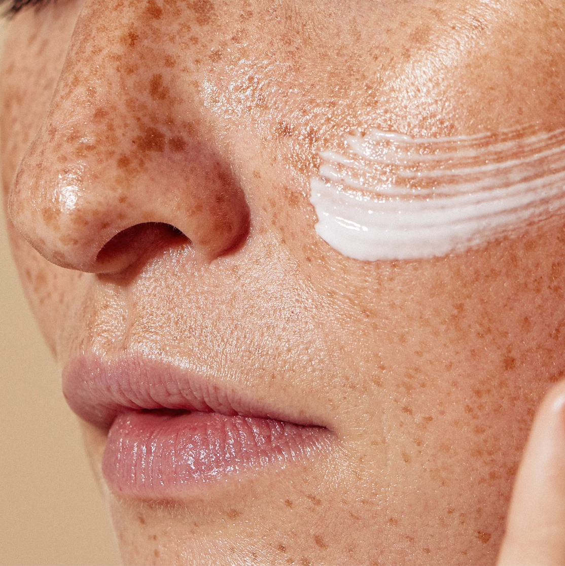 Fili di Biostimolazione PLLA PCL